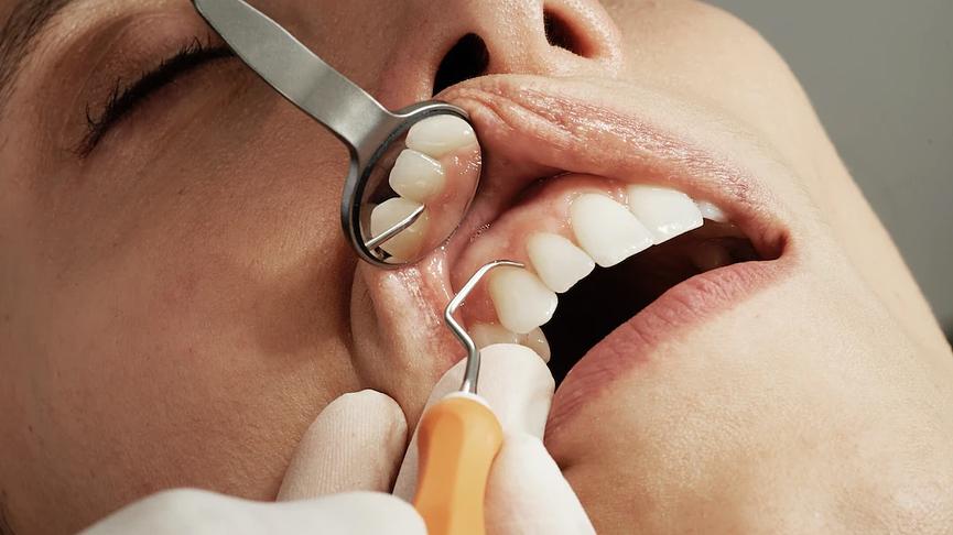 Bild 1 Patienten für kostenlose Parodontitisbehandlung 
