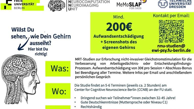 mind. 200€ für Teilnahme an MRT-Studie + Screenshots vom Gehirn